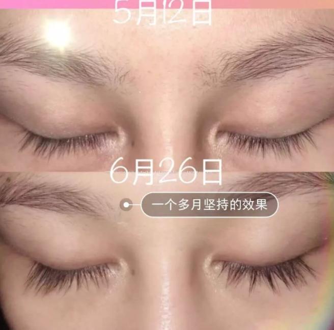 睫毛增长液真的有用吗测评,吉克隽逸睫毛增长液同款