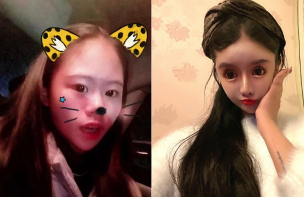 15岁网红自曝整形超100次，后遗症记忆力衰退，换脸停不下来