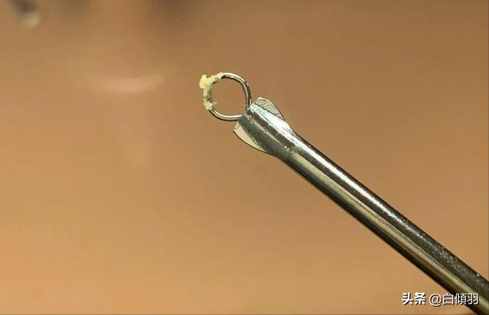 毛孔粗大全搞定这些知识要记牢,毛孔粗大真的能完全改善吗