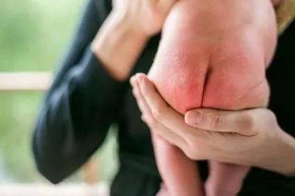 宝宝为什么一直红屁屁长疹子,为什么宝宝都会红屁股