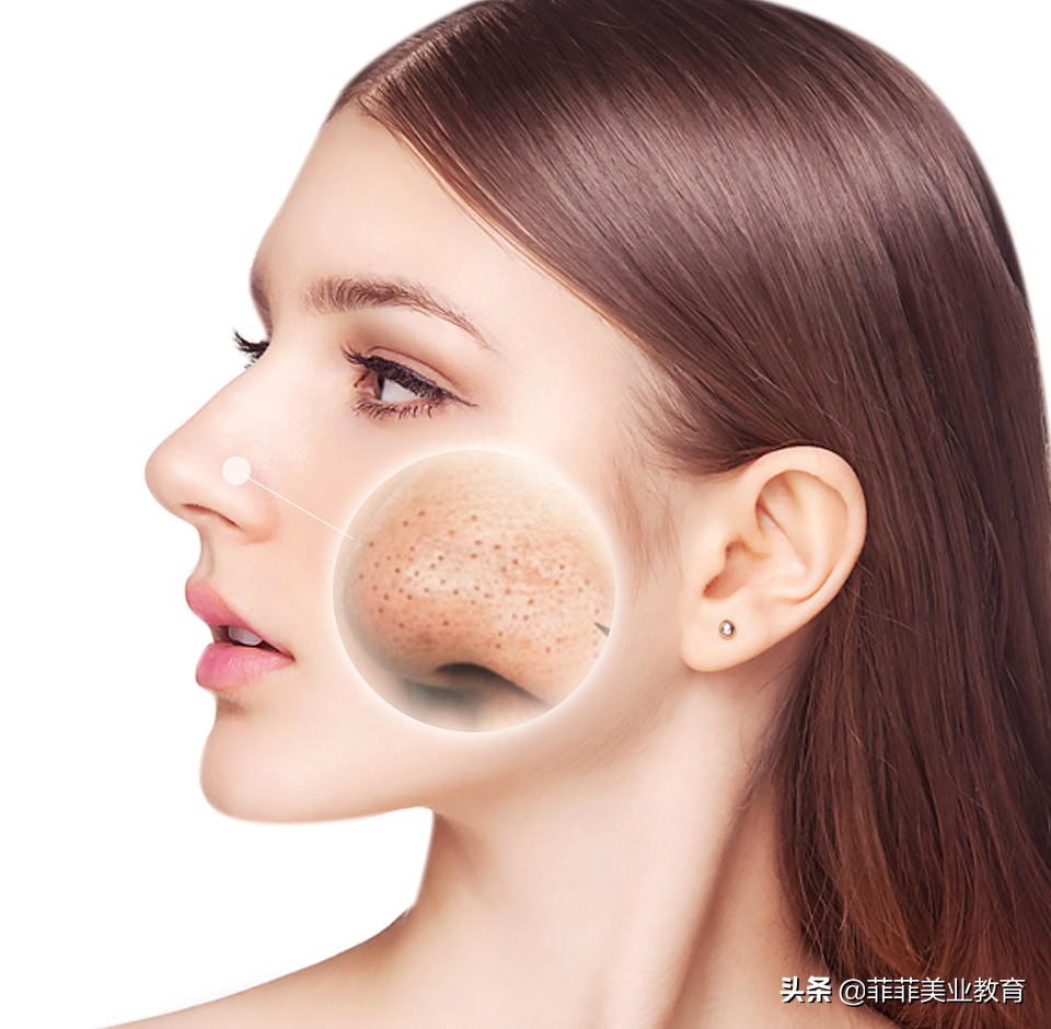 毛孔粗大怎么办教你快速收缩毛孔,毛孔粗大收缩毛孔最有效的方法