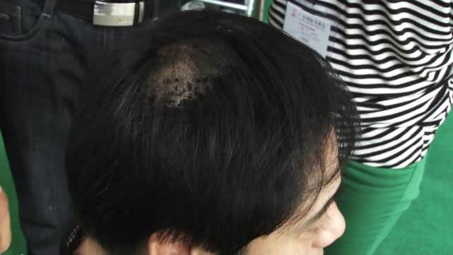 人到了什么年纪才算老,人到什么年纪衰老最快