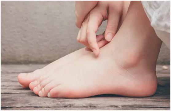 汗疱疹湿疹小妙招,湿疹和汗疱疹反反复复怎么办