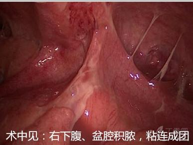 鍚村溅绁栫殑鐩茶偁婧冪儌鍘熷洜,鍚村溅绁栫湡鐨勬湁鐩茶偁鐐庡悧