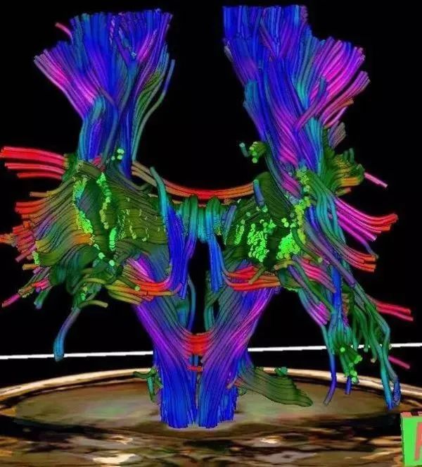 核磁共振能看出来哪些病症,核磁共振可以检查良恶性吗