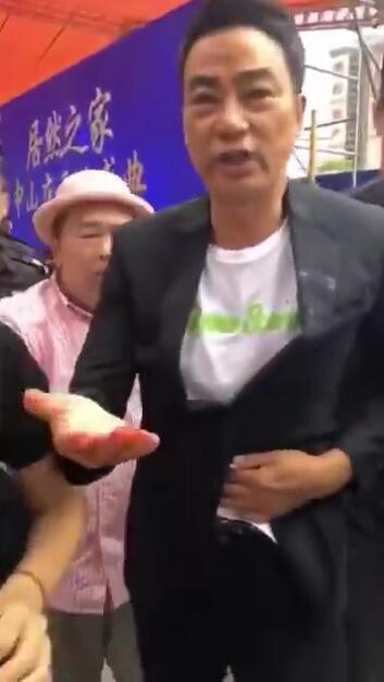 任达华手指伤重再做手术,任达华被捅伤在哪