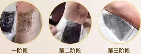 旅游一天脚痛怎么缓解,旅行时脚累怎么缓解