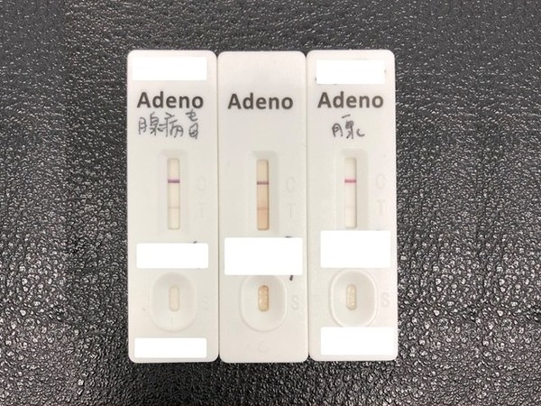 3岁儿童腺病毒一般多久能痊愈,三岁的宝宝腺病毒感染能自愈吗