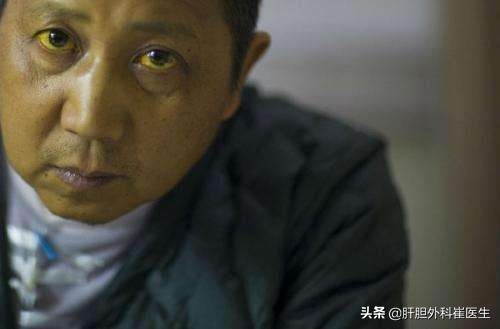 体检发现胆红素升高要注意，医生：3方面告诉你是哪些疾病造成的