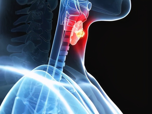 可怕！老人声音嘶哑到医院居然查出喉癌