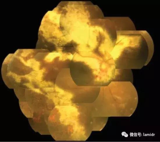 hiv感染症状及表现会口干吗,hiv的症状有眼睛红吗