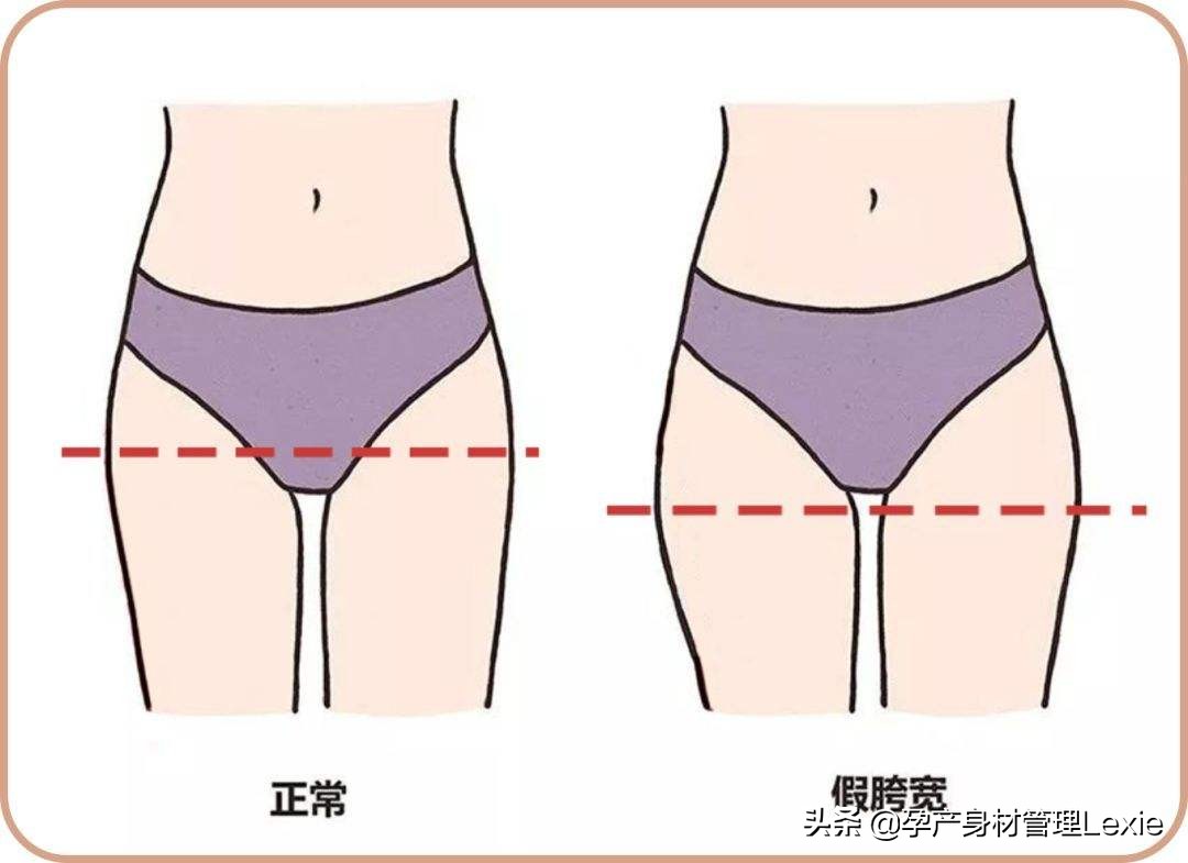 生完孩子屁股松了？都是“假胯宽”惹的祸
