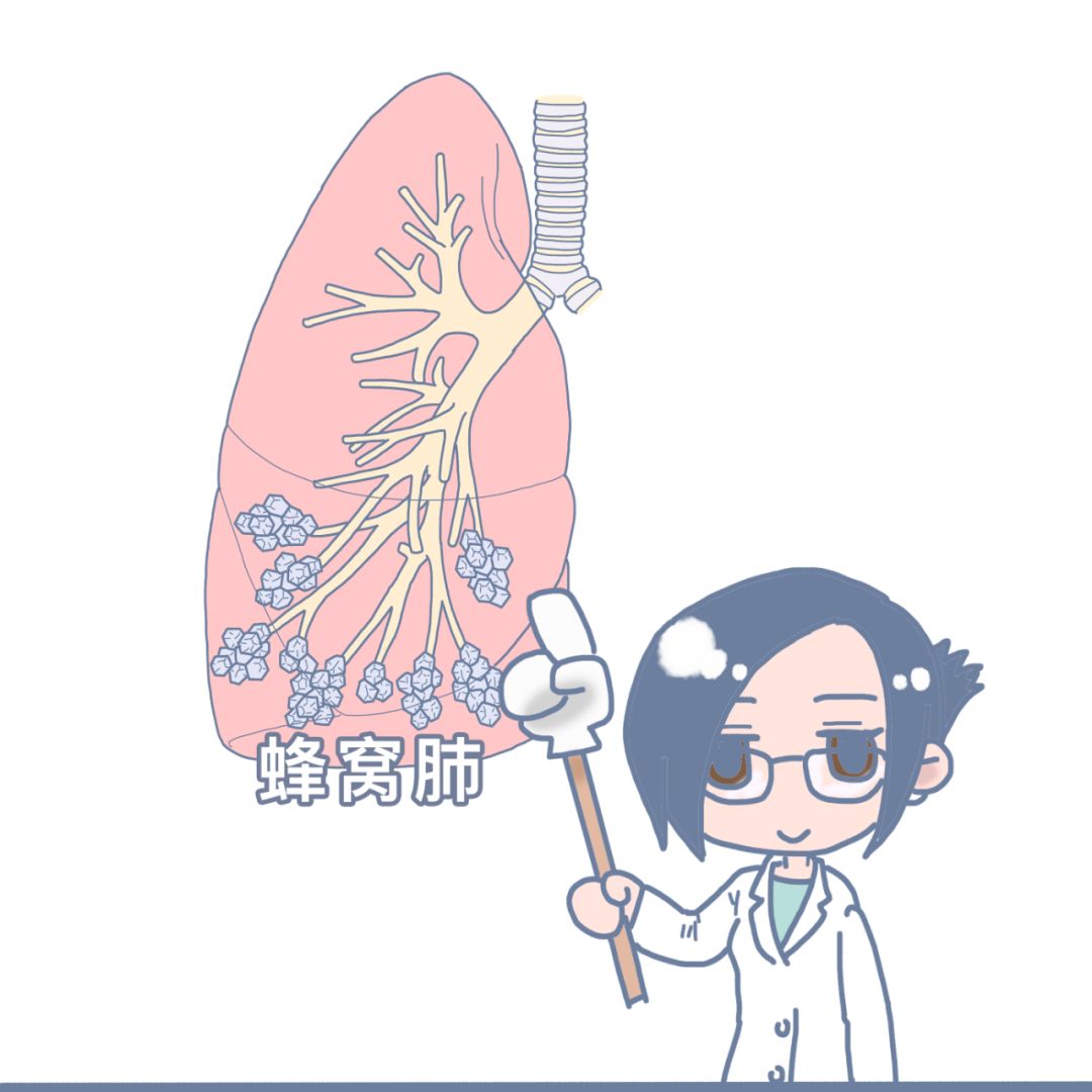 肺癌多大的概率会误诊,死亡率仅次于癌症的病