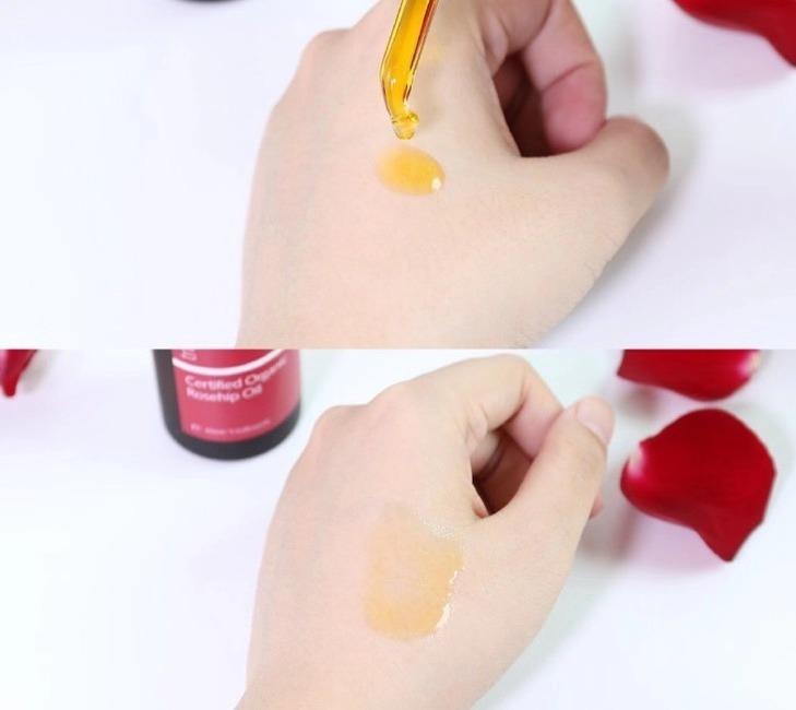 去痘印妊娠纹的神器,祛痘印舒缓精华油干皮