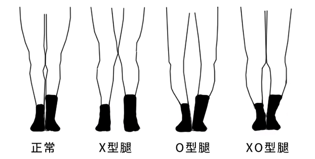 靠谱显高马丁靴,马丁靴人气款