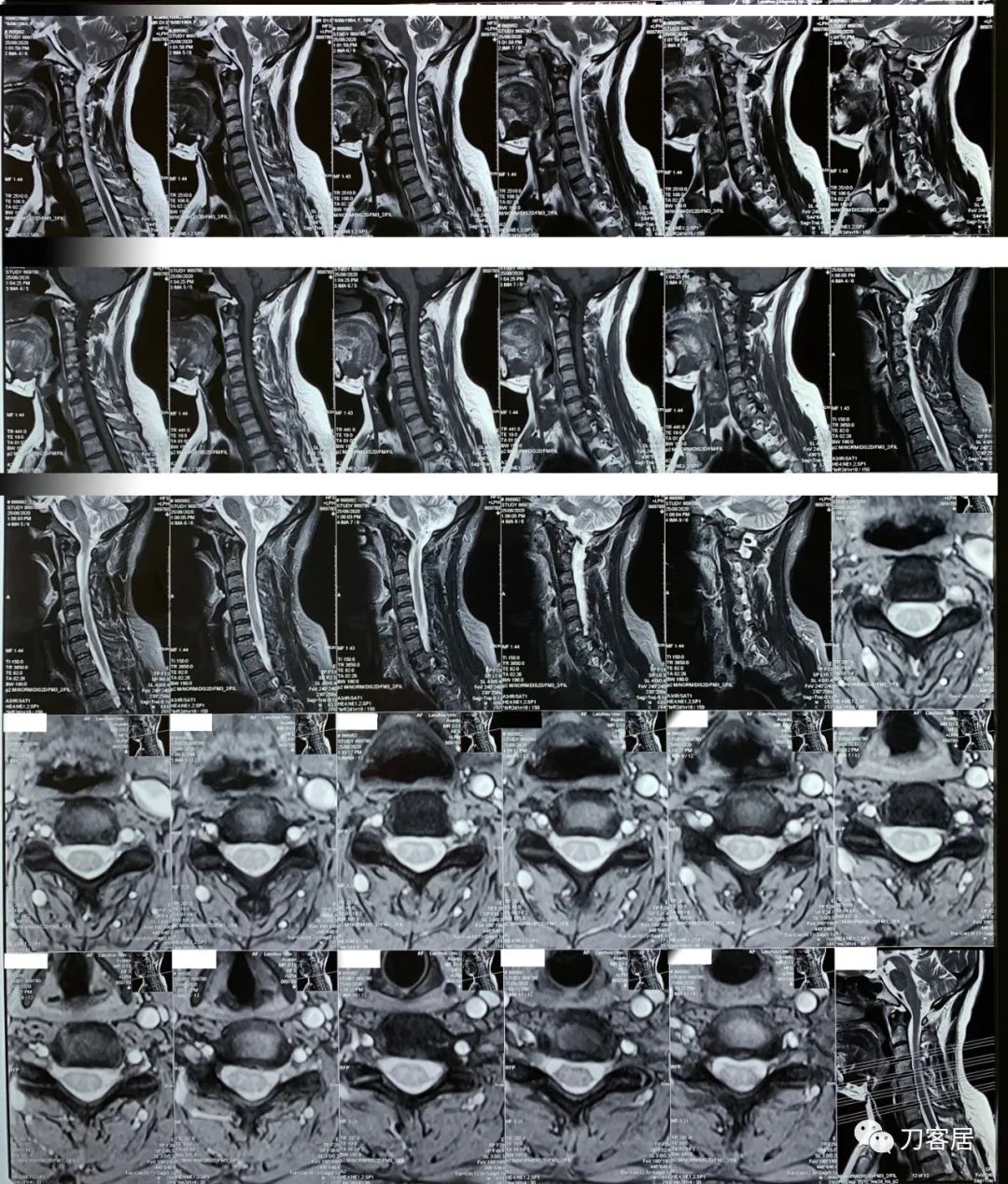 我的门诊病历,我的门诊