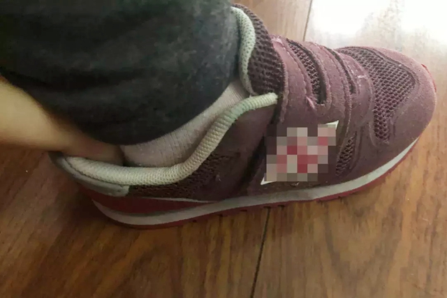 给宝宝选鞋子的讲究,给宝宝选鞋选什么样的鞋底