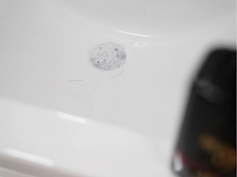 发际线保卫战如何打赢,发际线保卫战完整版