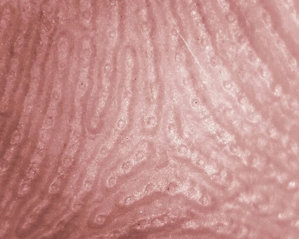 有哪些无指纹的人,没有指纹的人有什么缺点