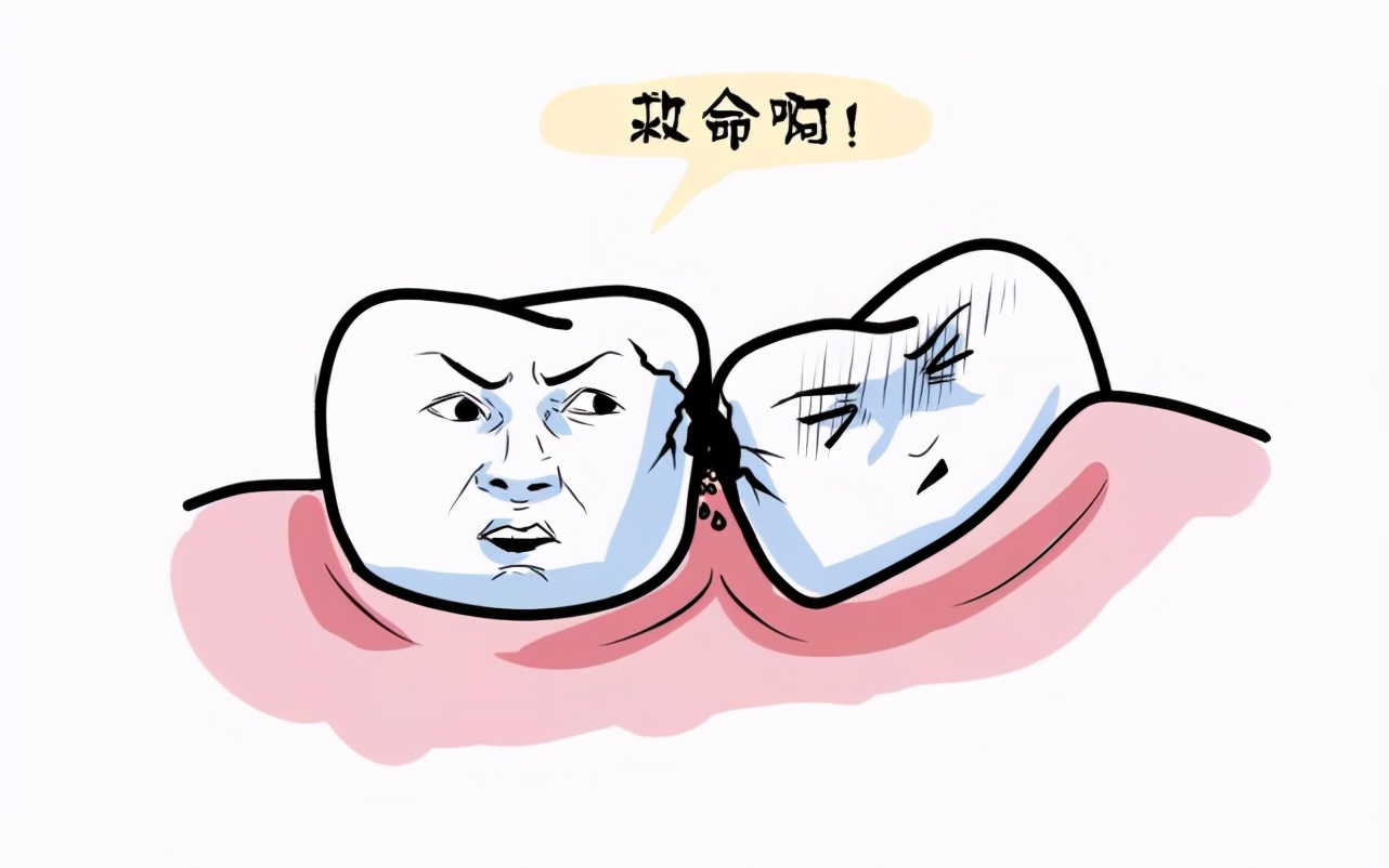 智齿真的没有一点用处,不聪明的智齿