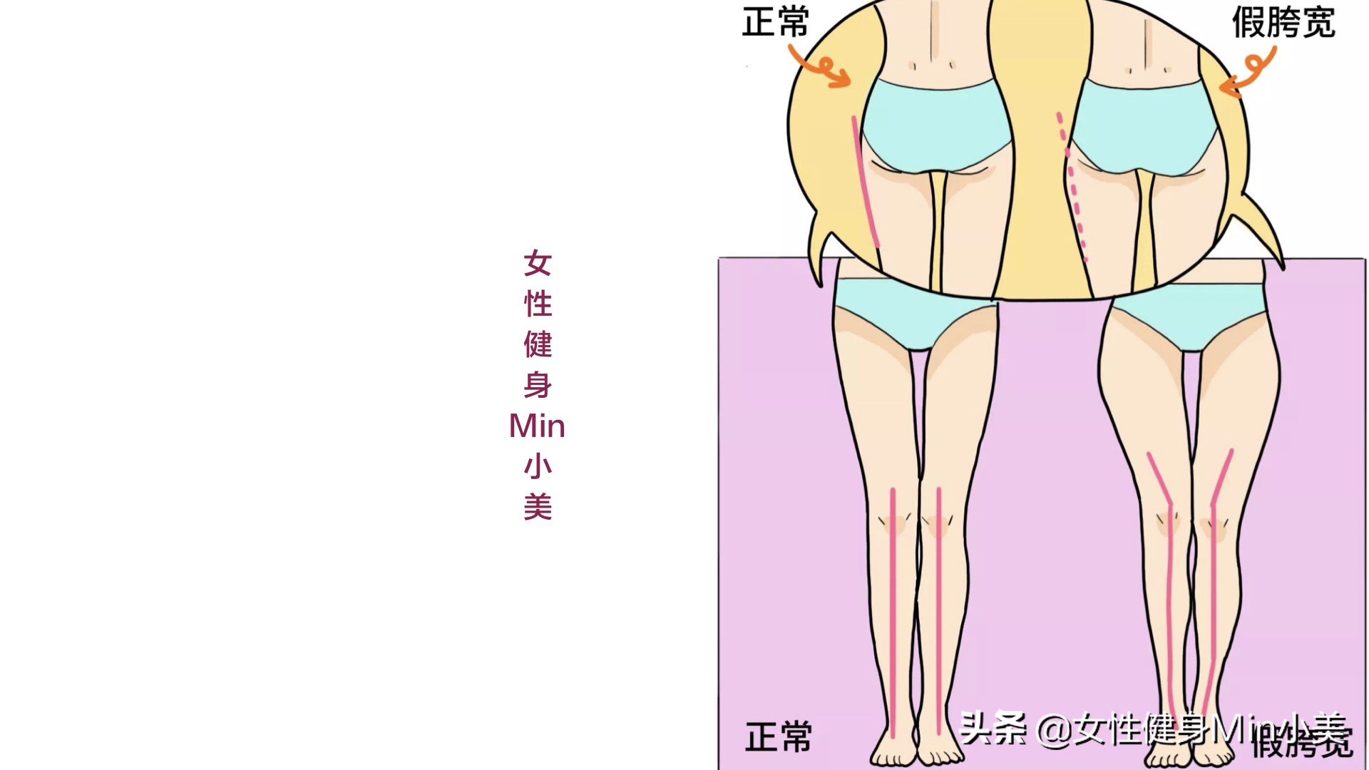 假胯宽、大腿外侧太粗都和它有关，一套动作帮你改善，重点是坚持