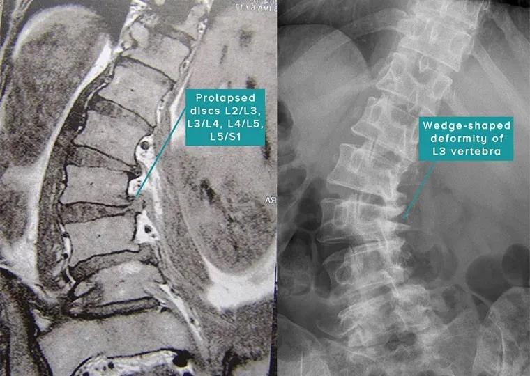 sps鍒涘浜虹悊鏌ュ痉,鐞嗘煡寰蜂翰鎺坰ps瀵煎笀