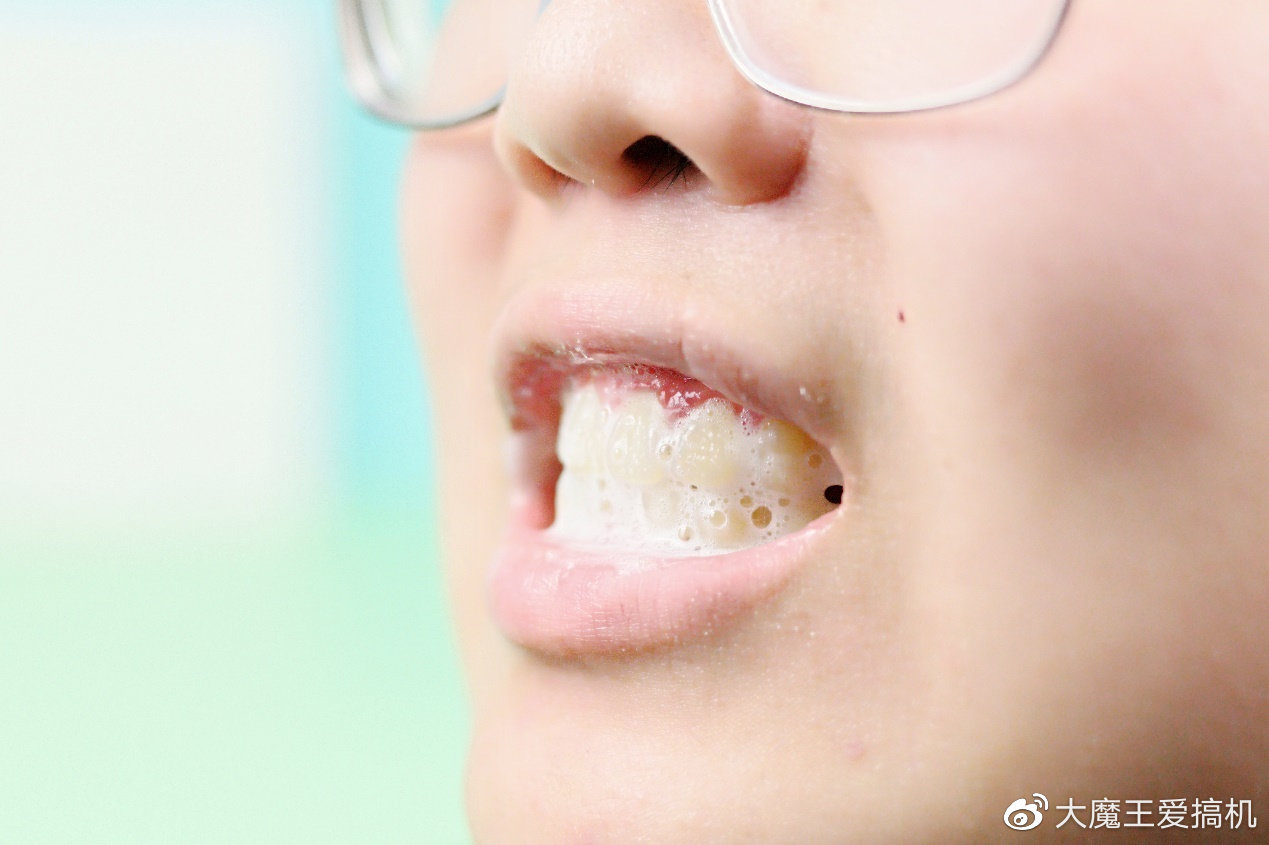 黑科技抗敏感牙膏,黑科技牙膏让烂牙齿变白