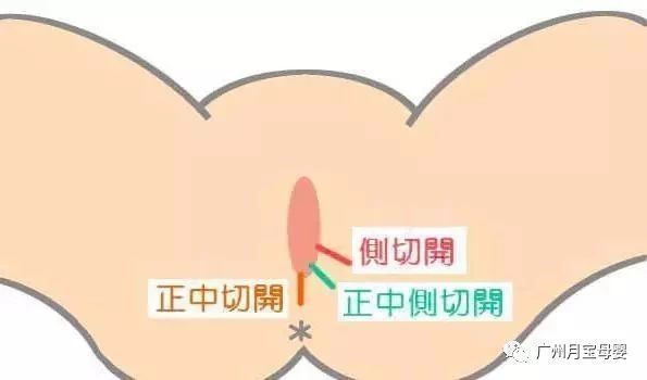 屁股大的女人生育好吗,屁股大的女生好生养