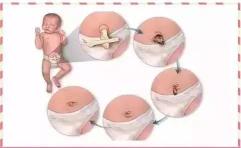 新生儿脐带有点出血怎么处理,新生儿脐带有点出血在家怎么处理