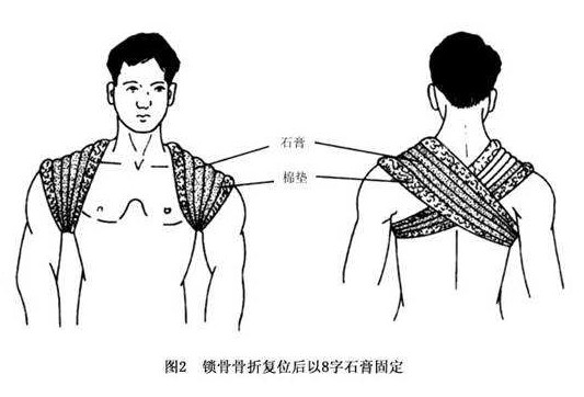 有多少脊椎病，是按出来的？