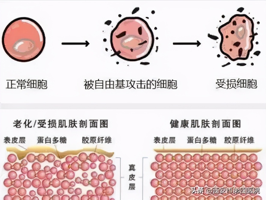 脸上毛孔大靠什么医美解决,毛孔粗大如何正确护肤