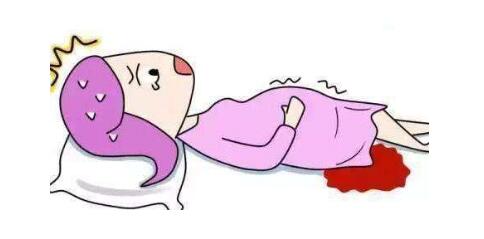 宫外孕失血1000毫升危险吗,宫外孕大出血是流掉了嘛