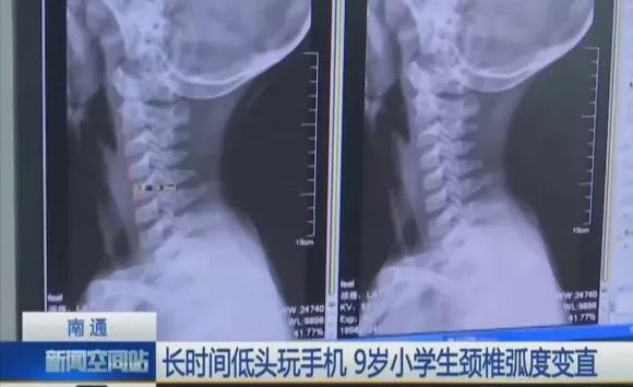 平视不低头平板支架,懒人手机支架360可旋转落地