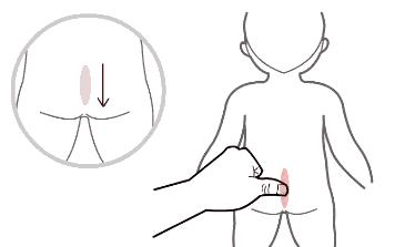 孩子腹泻食疗最简单方法,小儿推拿专家陈红主任腹泻手法