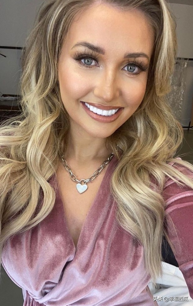 艾米·哈特反馈粉丝质疑脸整容