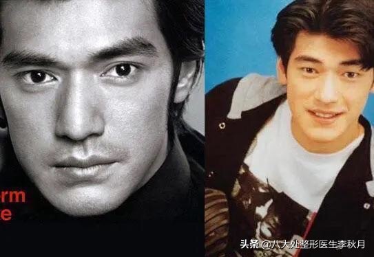 双眼皮刚做完很好看越恢复越难看,双眼皮做完感觉自己睁眼睛不自然