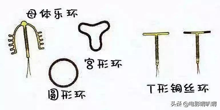 宝宝握着节育环出生,拿着节育环出生的宝宝