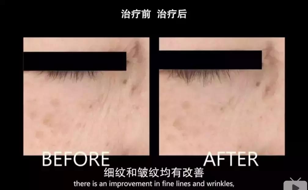 bbc纪录片整形美容的真相,美容治疗的真相bbc