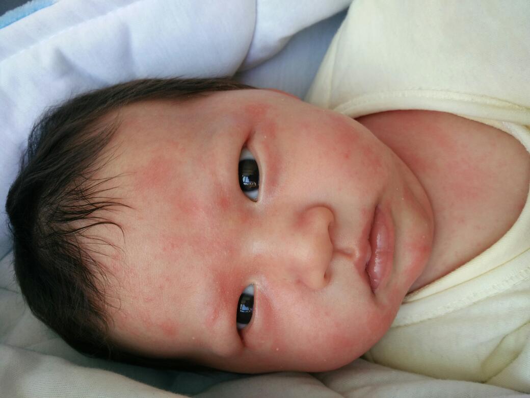 孩子生病不能吃发物应该吃哪些,记住孩子生病这些东西千万别乱吃