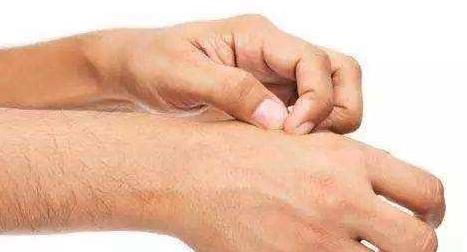 湿疹问题在哪里,湿疹症状健康科普