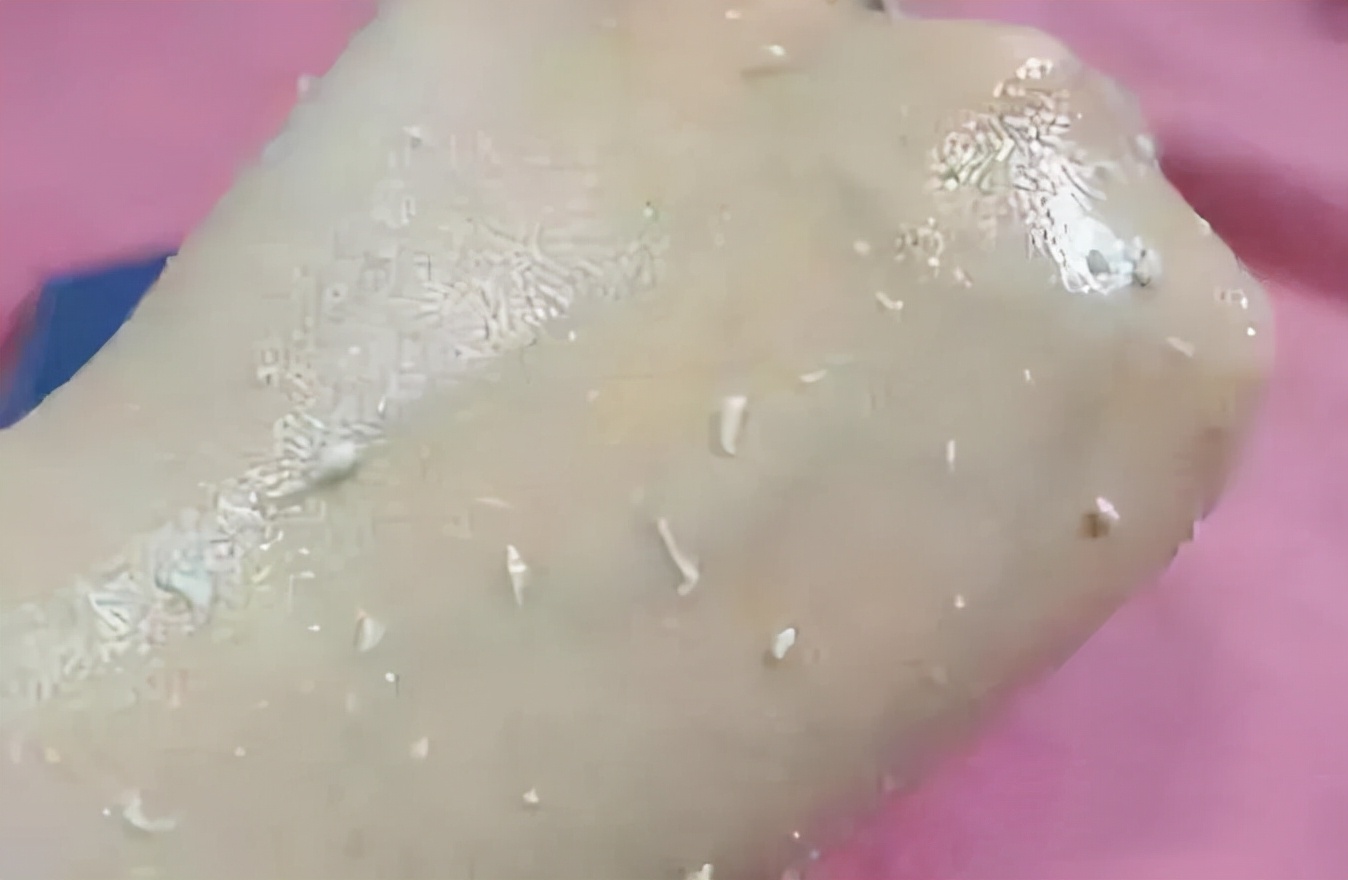 为啥要去脸部角质,为什么要去皮肤上的角质