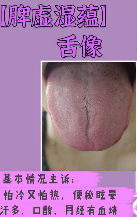 健脾胃治脾胃不和中成药,脾胃不好百病生怎么办