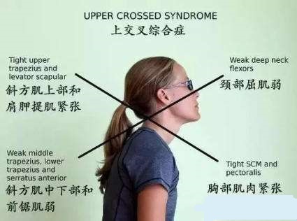 经常低头看手机的颈椎怎么矫正,抬头看手机对颈椎有好处吗
