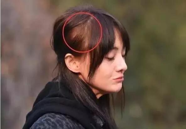 沙宣洗发水掉头发,沙宣洗发水洗了脱发