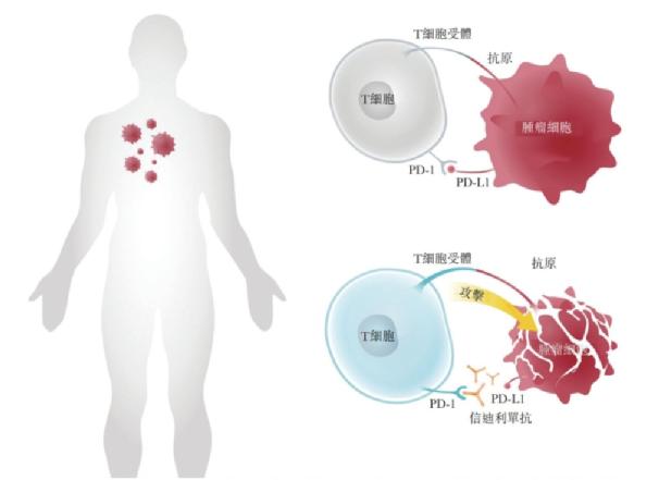 可以治疗癌症的天价药,治癌特效药最新消息医保