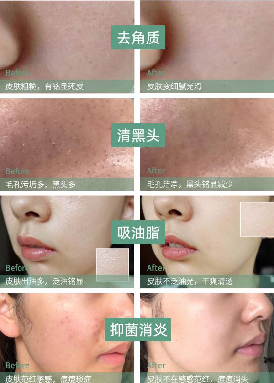 张韶涵海蓝之谜,张韶涵护肤视频完整版