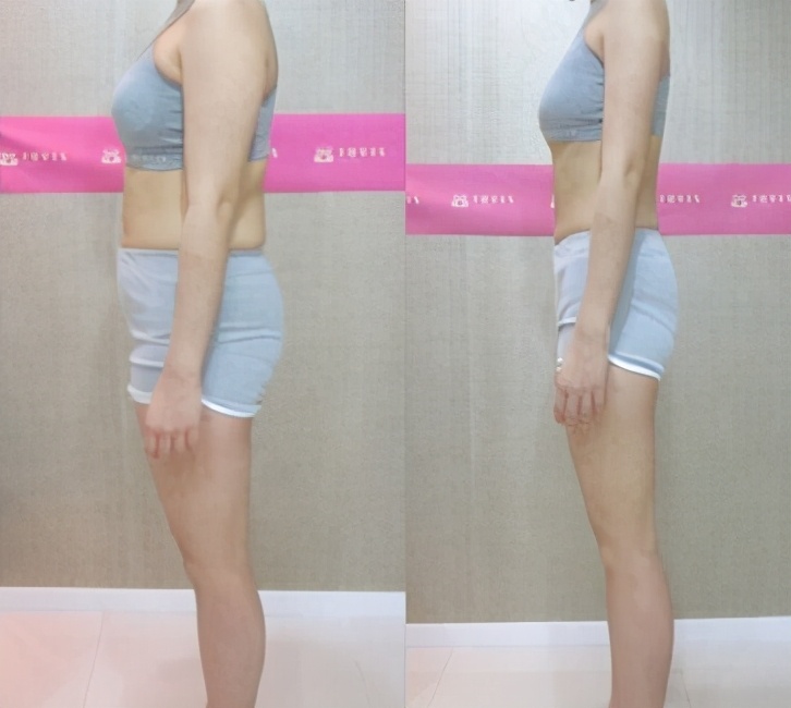 别人生完看不出，自己生完回不去，“产后易瘦体质”有哪些特征？