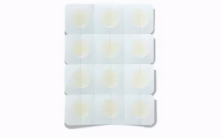 脸上长痘是身体原因还是皮肤原因,脸上长痘可能是什么病引起的