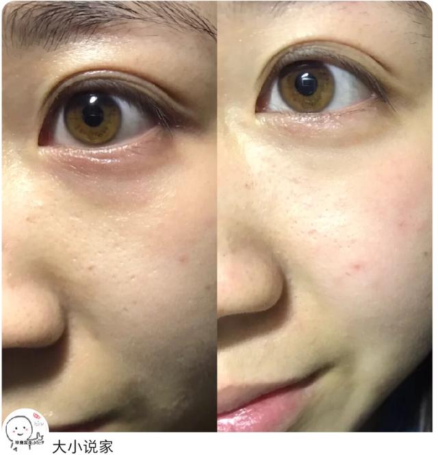 4款国货眼霜,眼霜红黑榜贵妇