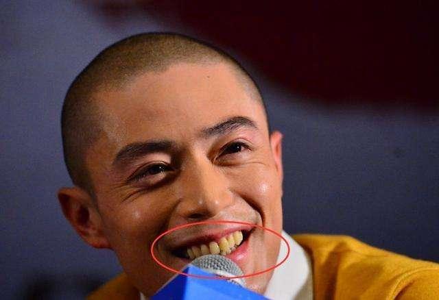 刷牙去牙垢烟垢黄牙最有效方法,刷牙多久才能消除牙黄味